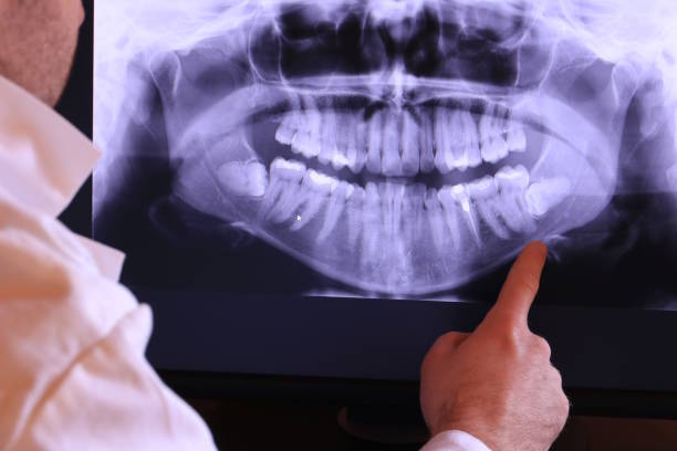 Best Emergency Dental Care for Broken or Chipped Teeth in Malta, IL