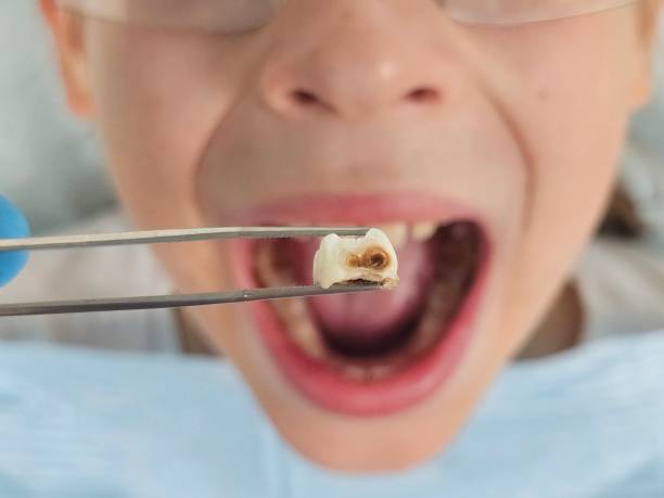 Best Emergency Treatment for Dental Infections or Abscesses in Malta, IL
